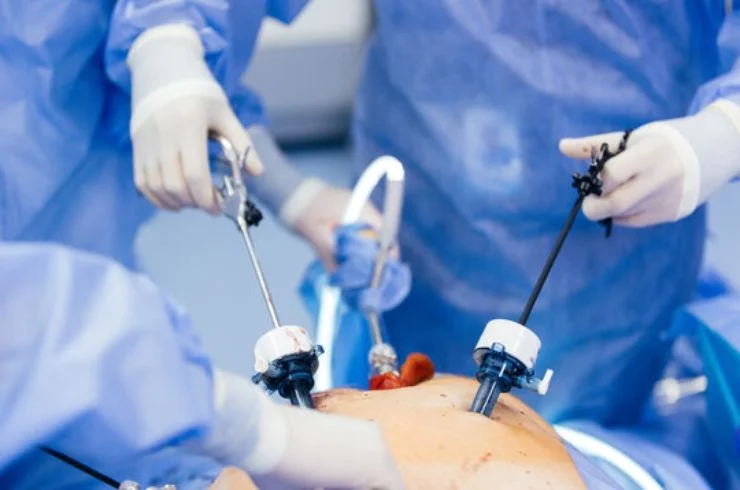 Advanced Laparoscopic Surgery