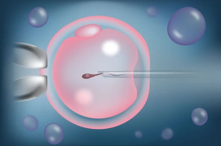 Intracytoplasmic Morphologically