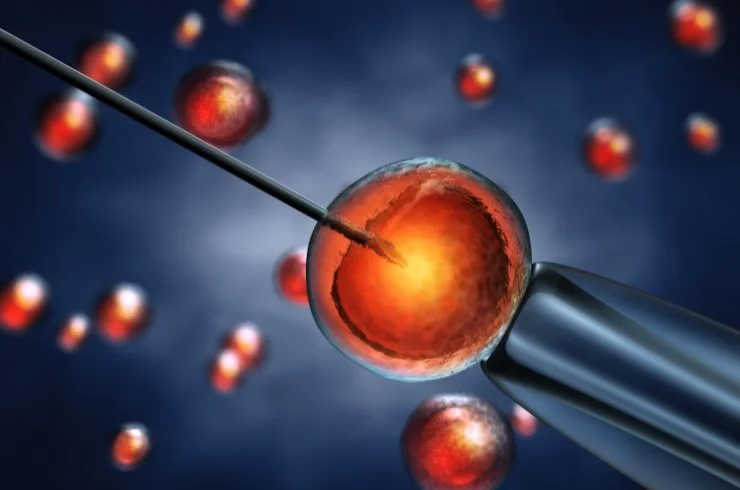 Intracytoplasmic Sperm Injection