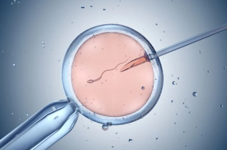 in vitro fertilization